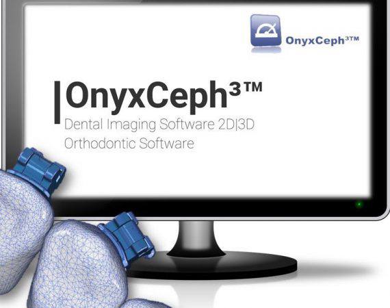 OnyxCeph