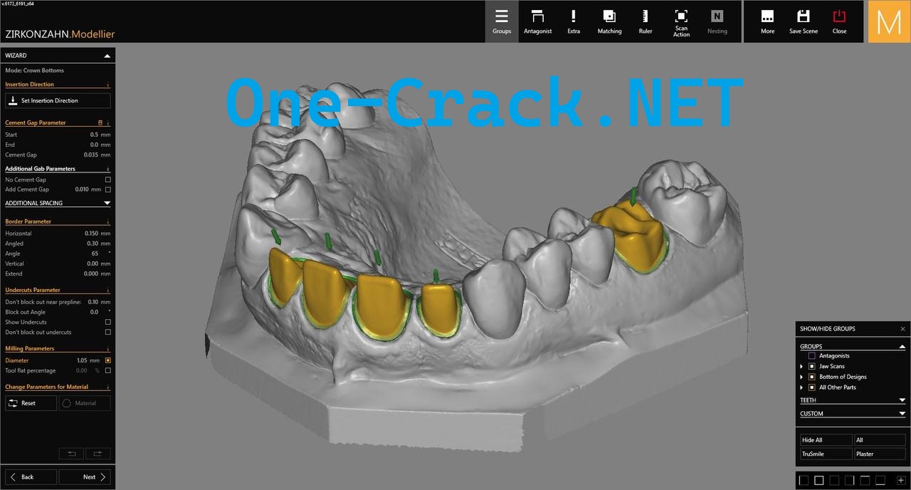 ZirkonZahn Modellier Full